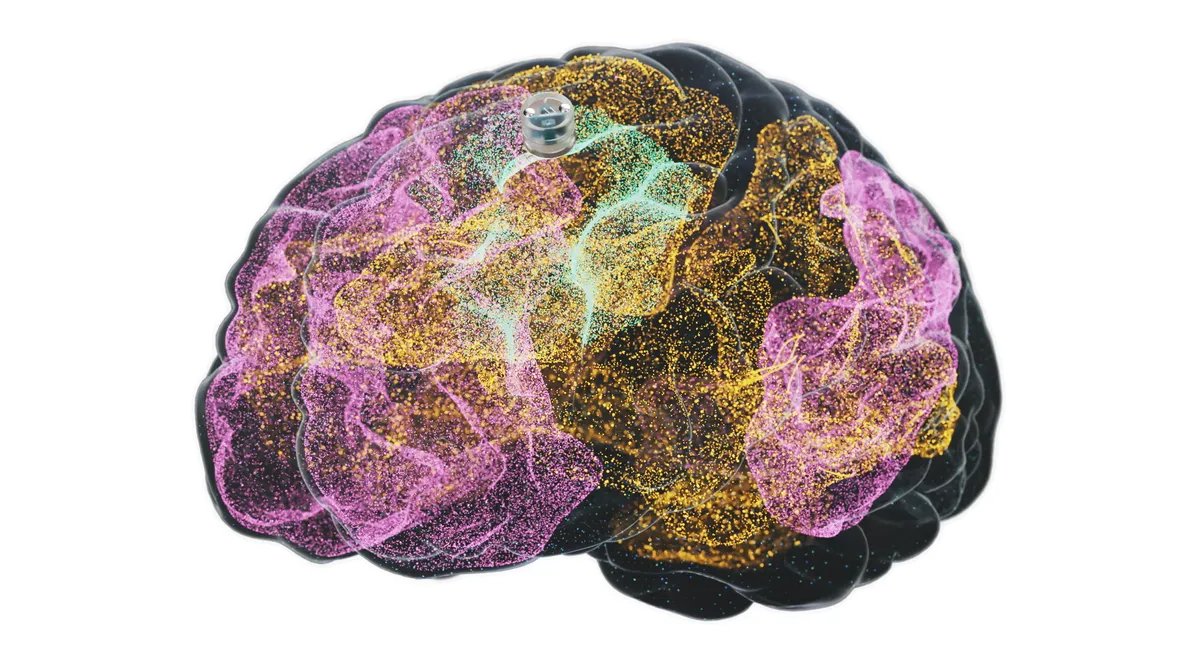 Depressiyaya Qarşı Beyin İmplantı İnsanda Test Edilməyə Hazırlaşır