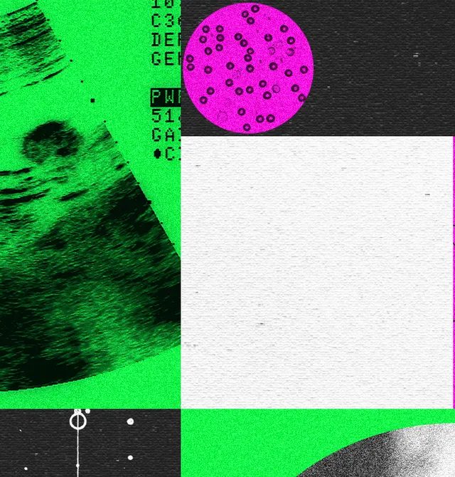 Gen Dəyişdirilmiş Körpə Şirkətləri Böhran İçindədir