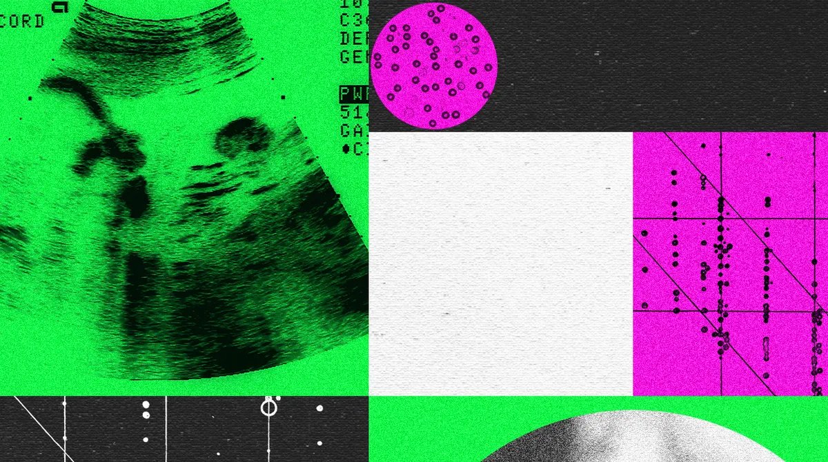 Gen Dəyişdirilmiş Körpə Şirkətləri Böhran İçindədir